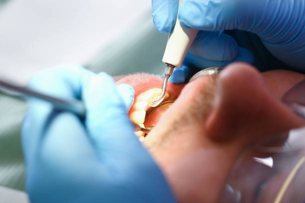 Best Walk-In Emergency Dentist in Eslon, CA