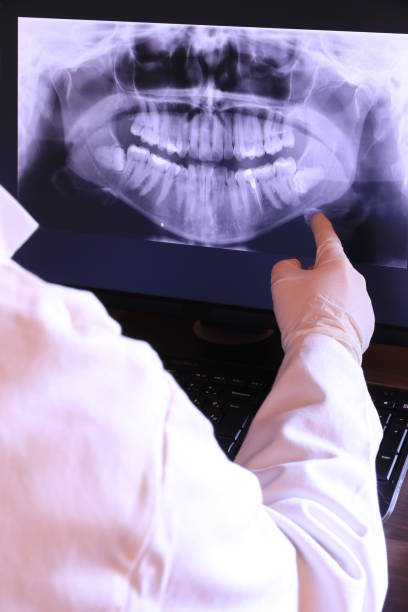 Best Emergency Broken Tooth Repair in Eslon, CA